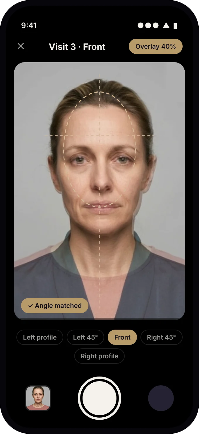 Photo capture with angle overlay