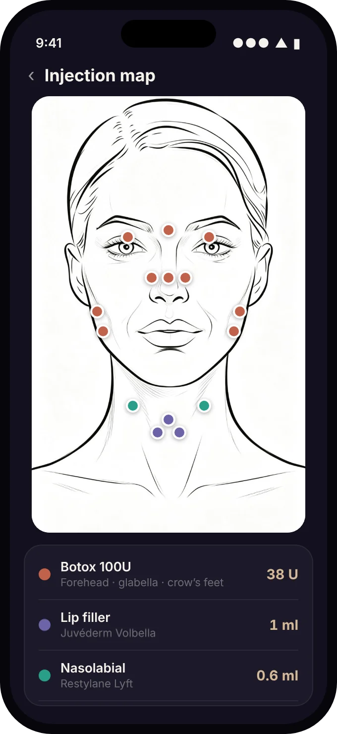 Injection map